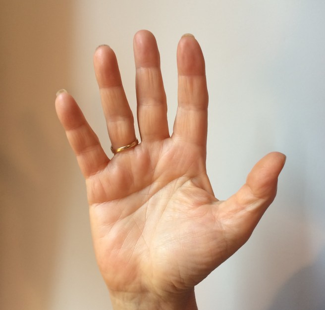 Marian Rivman's right palm